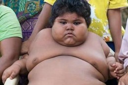 picture of fat kid high cholesterol