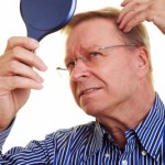 picture of man with hair loss